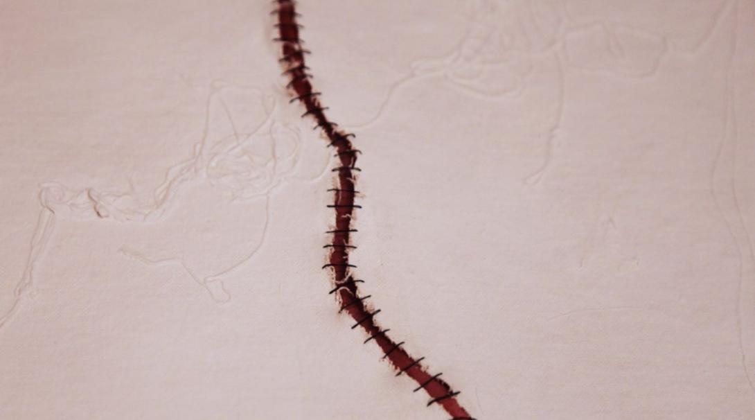 The Gift of Scars