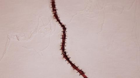 The Gift of Scars